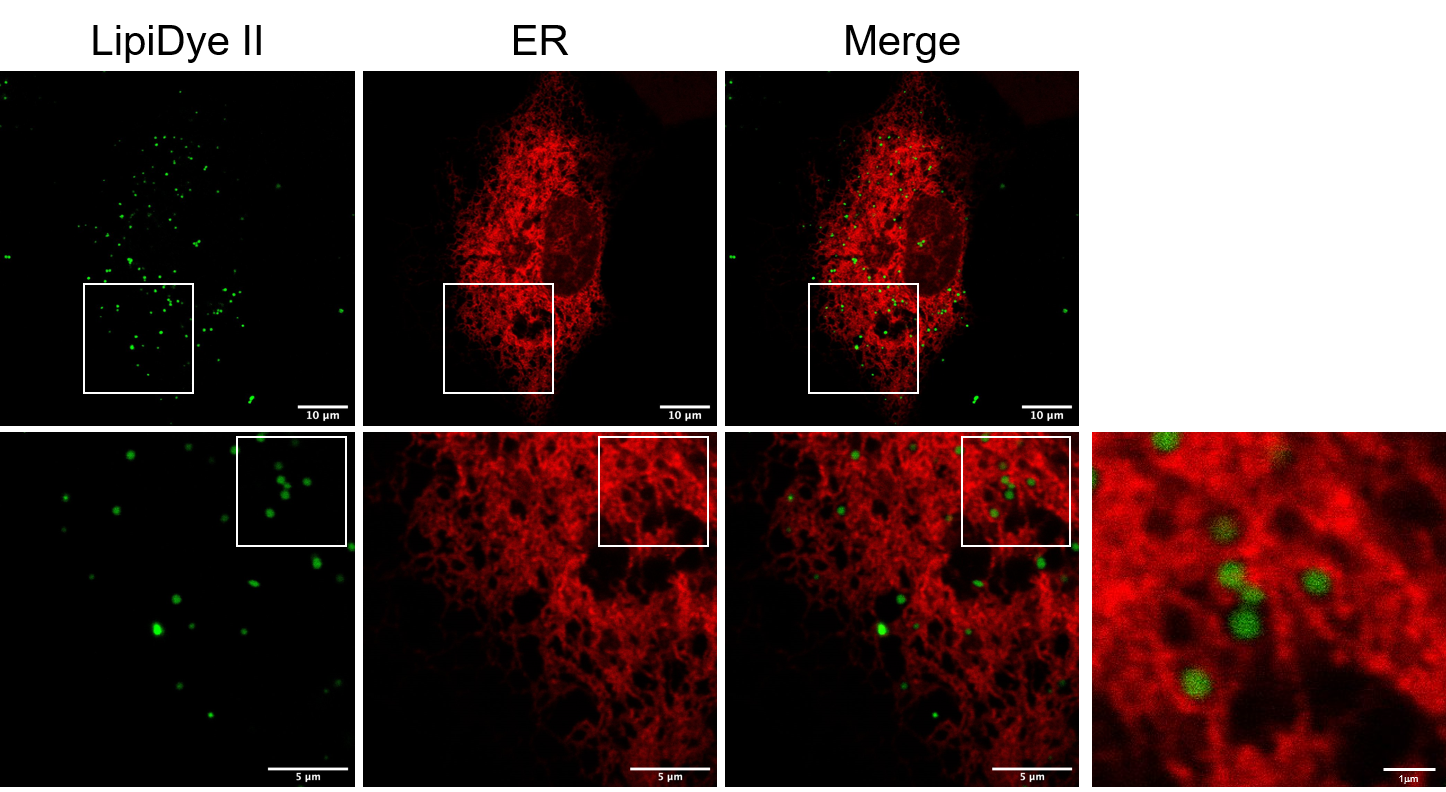 FNA-80682-data staining with ER-2.png